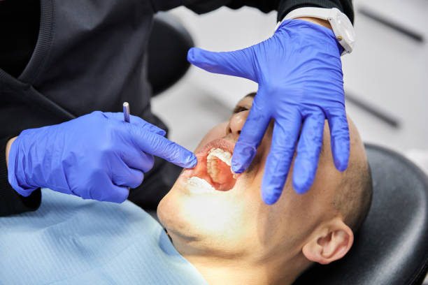 Best Emergency Wisdom Tooth Extraction in Wamego, KS