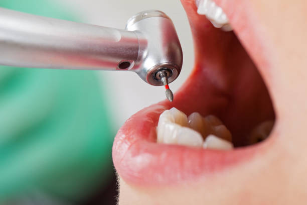 Best Weekend Emergency Dental Services in Wamego, KS